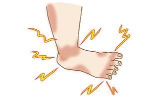 タコ、ウオノメ、むくみ、関節痛は足が壊れる前兆!?