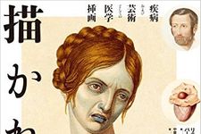 『描かれた病:疾病および芸術としての医学挿画』リチャード・バーネット著