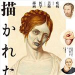 『描かれた病:疾病および芸術としての医学挿画』リチャード・バーネット著