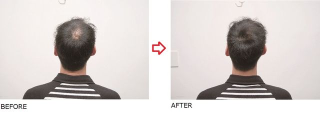 坊主頭はよけいに薄毛が目立つ 美容師が教える薄毛隠し最前線 最速でバレずに気になる薄毛をカバーする ばっちりキマる For Men Bookウォッチ 坊主頭はよけいに薄毛が目立つ 美容師が教える薄毛隠し最前線 最速でバレずに気になる薄毛をカバーする ばっちりキマる For Men Bookウォッチ