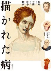 『描かれた病:疾病および芸術としての医学挿画』リチャード・バーネット著